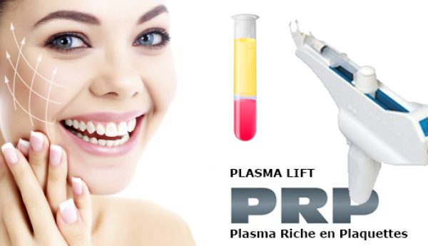 PLASMA-LIFT injection de  PRP platelet-rich-plasma - anti age - rajeunissement du visage  - PRP - Platelet-rich plasma