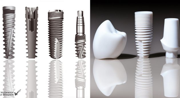 implant dentaire paris caroussel
